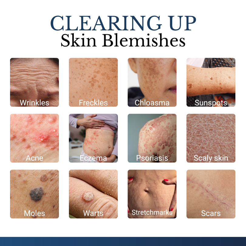 ✨Buy 1 Get 1 FREE Today Only – Clinclii® DermFixPro 2-in-1 Microneedle & Hydrocolloid Patch